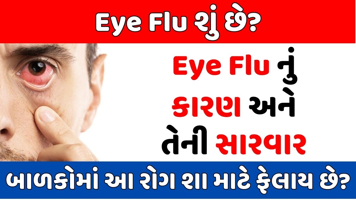 Eye Flu શું છે? Eye Flu નું કારણ અને તેની સારવાર